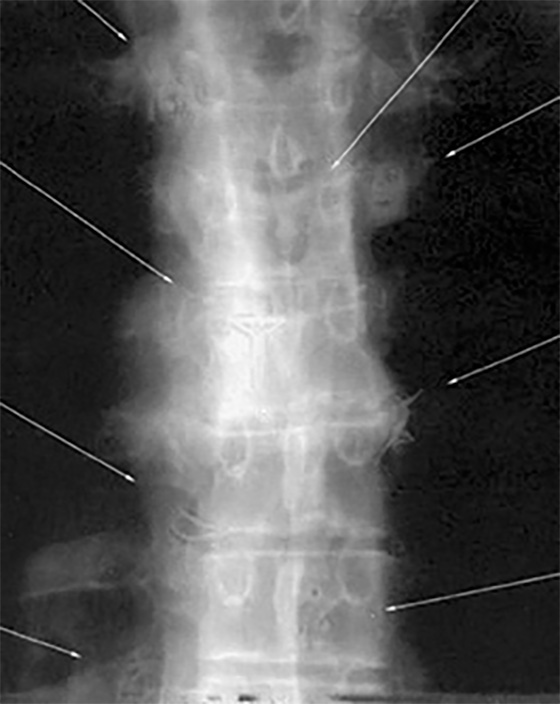 Spine